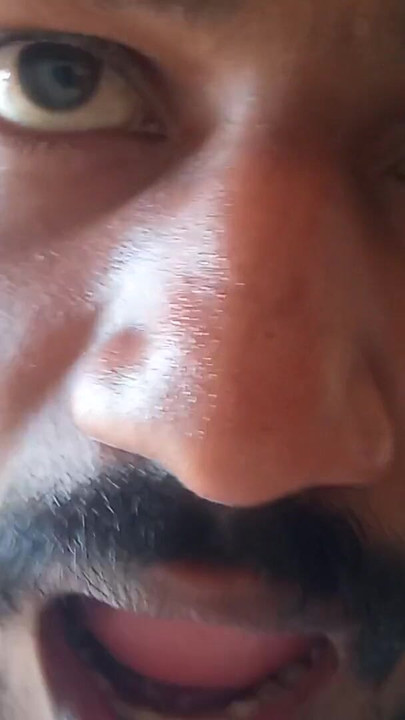 人们需要闪光者在世界上 |剪辑 1