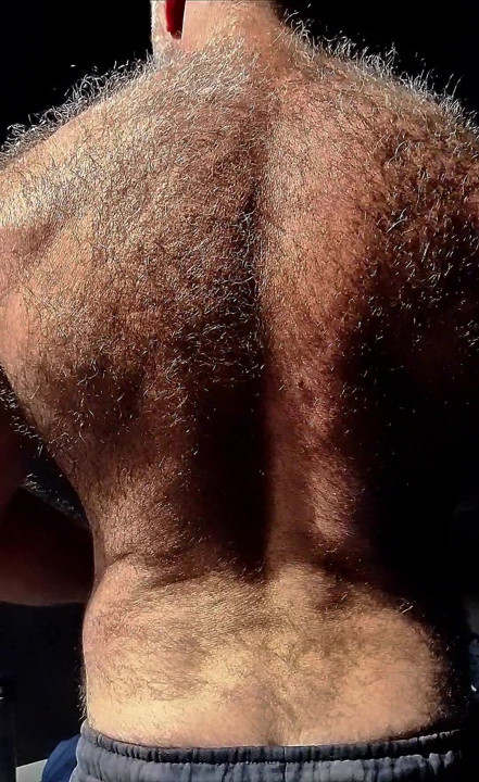 my HAIRY BACK