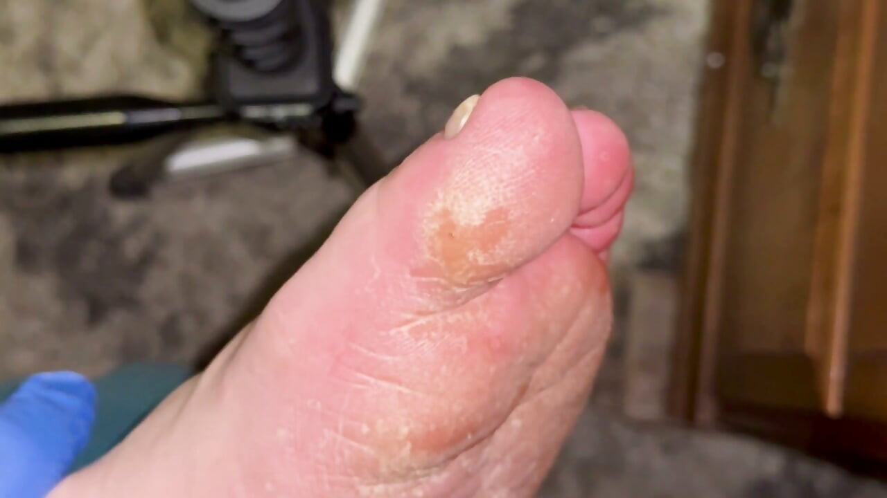 Crusty Foot Care and Worship - FTM