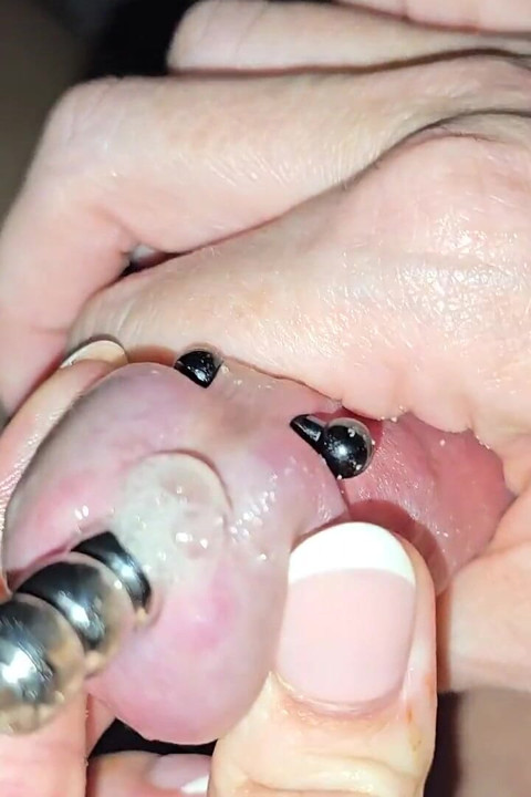 I Sound His Cock Until He Burst His Balls All Over My Hands