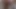 Lizzy Yum VR June 2023 JUST my PUSSY #12 post op orgasm pussy masturbation teasing orgasm
