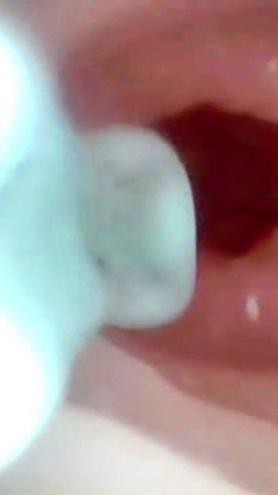 A detailed examination of Lopuza93 oral cavity and anal area using an endoscope camera. | Clip 2