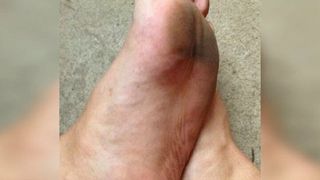 Meine schmutzigen Fußsohlen (Diashow)