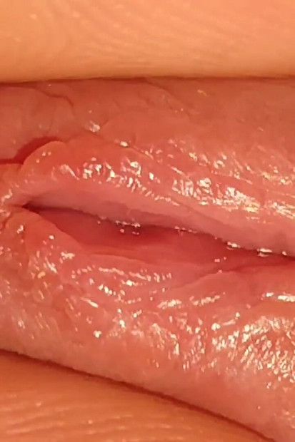 How to Widen a Glans Hole to the Extreme.