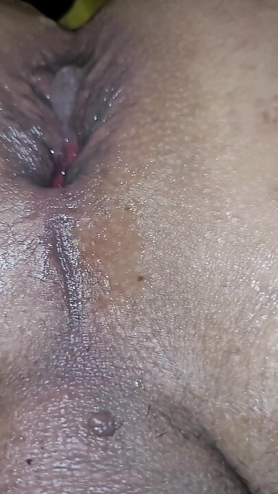 My anal close-up
