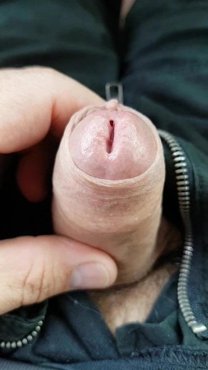 Foreskin playing 2
