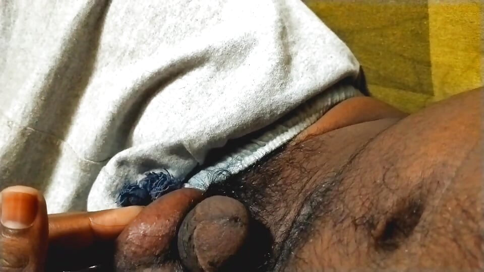 Hairy ball