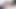 オタクの赤毛が痛む足に注意を払う