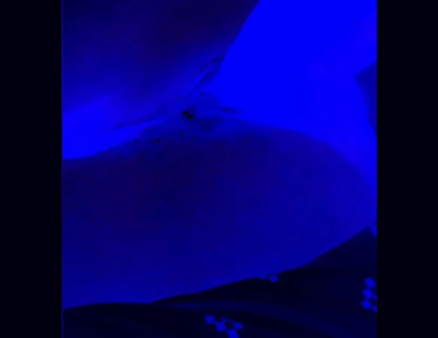 Anal blue