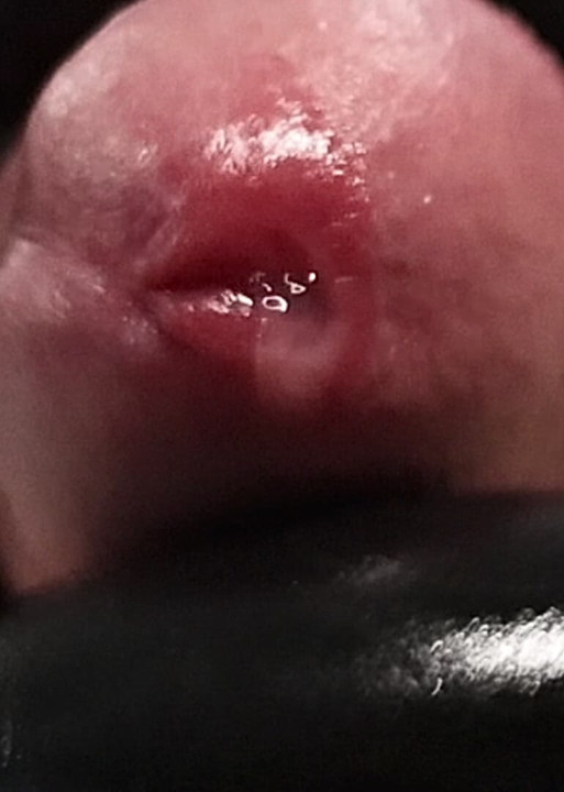 Vibrating Cum Reaction