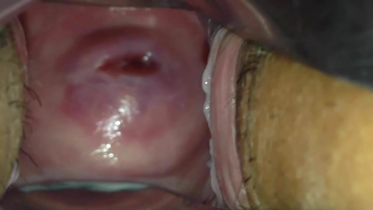 cervix