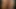cock sounding cumshot
