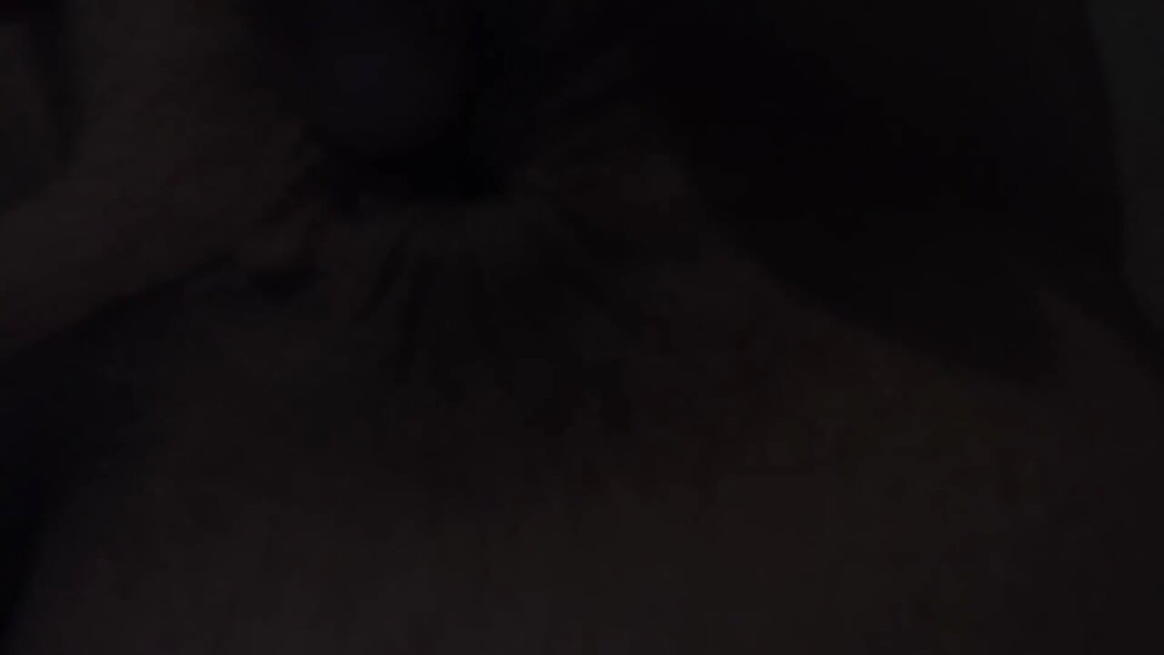 炫耀我那怪形的褶皺洞括約肌