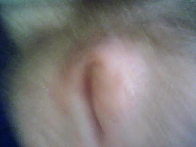 My Prostate
