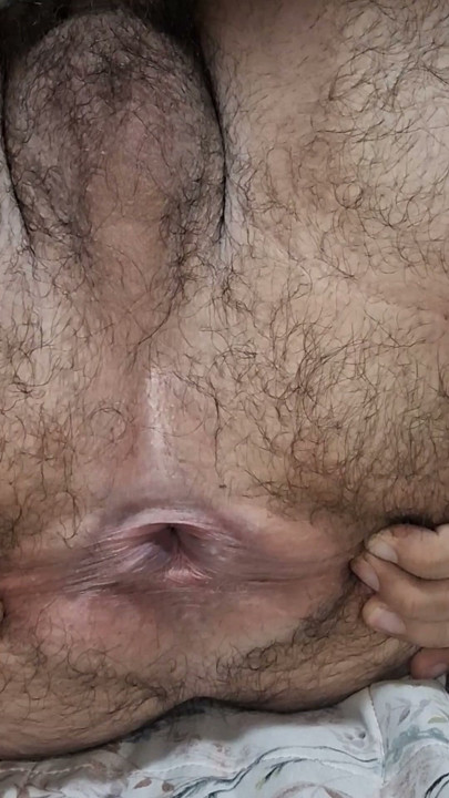 My butthole