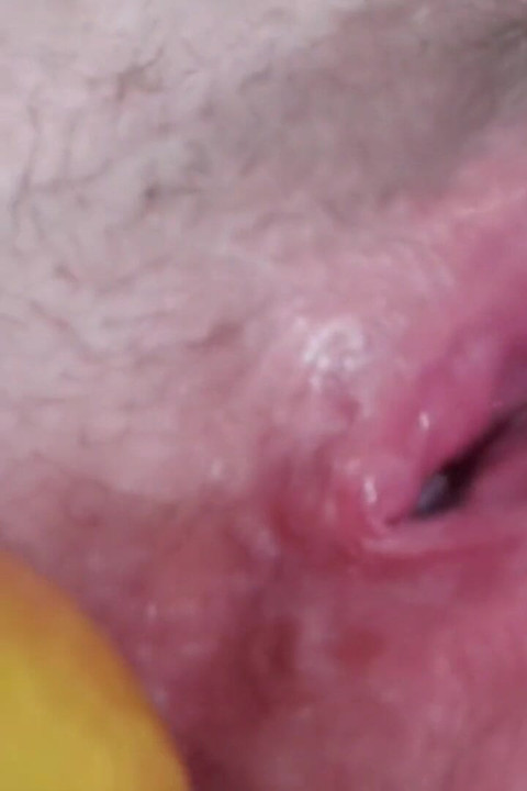 Ακραίος χυμός