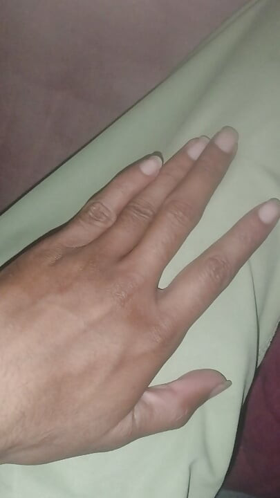 Siapa yang mahu dicakar oleh kuku saya