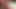 Masturbation
