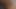 Kendime Bir Lüks Verdim Üvey Kızıma Anüsünden
