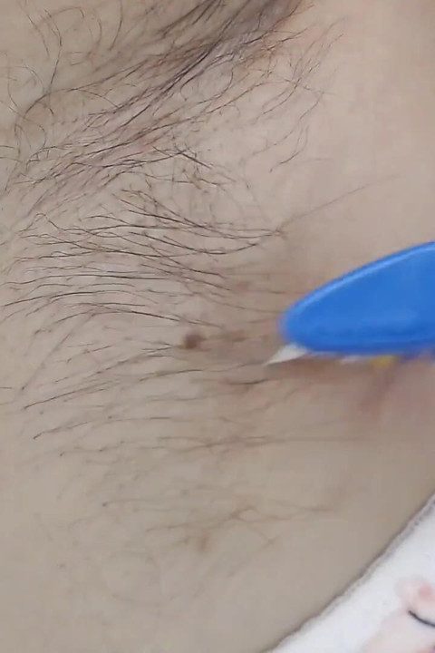 Hairy Armpits Closeup Oiled Combed