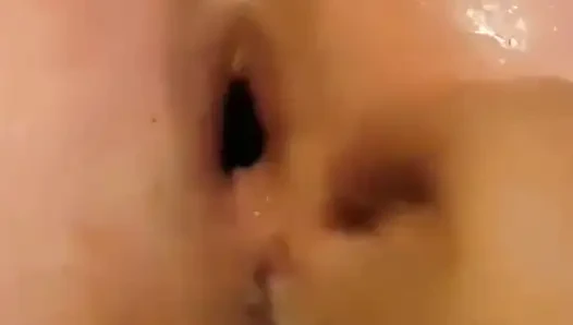 Extreme Anal Fisting, Gaping and Huge Rosebud/prolapse