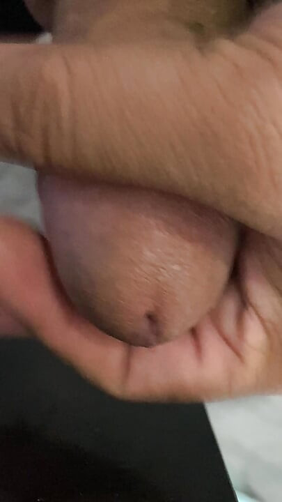 A lump of leftover flesh is growing in a rage, it must release the slime contained in it in the most drastic way
