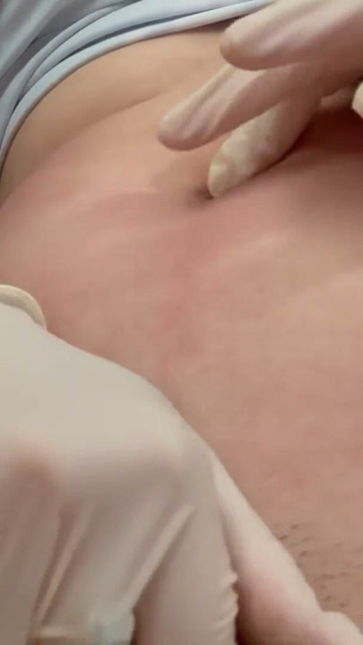 医療用手袋でへそを弄ぶ | Clip 1