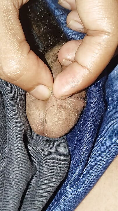 Acne on my penis I want to clean it up