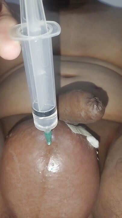 2 litre saline injection