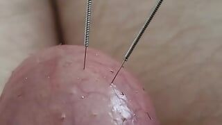Needles in an egg