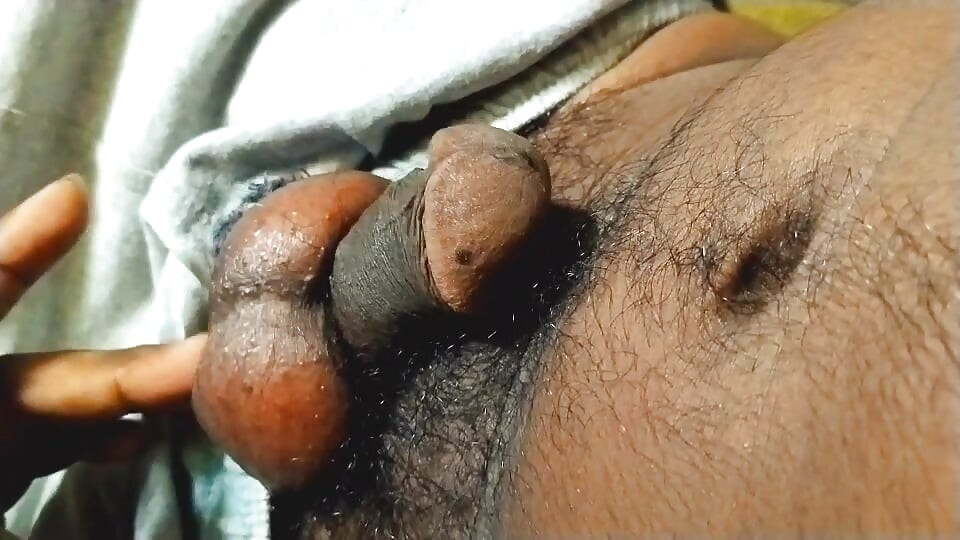 Hairy ball