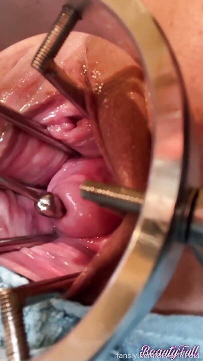Exploring My Cervix With Sound And Fingers