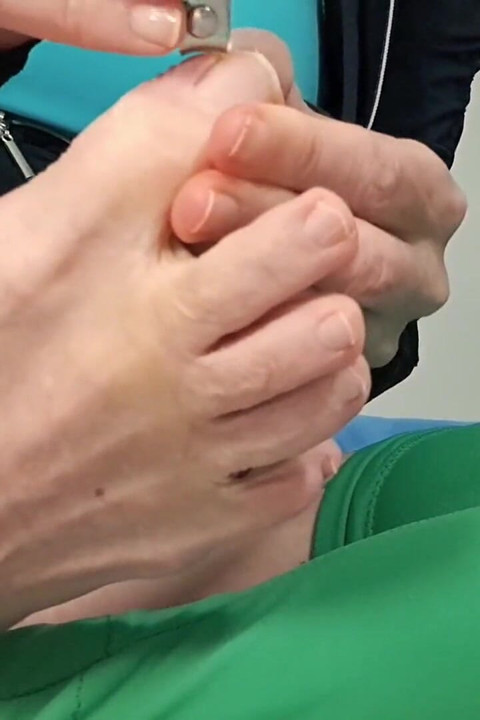 Cutting Toes Nails Feet Fetish