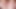 継母があなたに彼女の広げたアソコとアナルを点検してほしいと言っています - アソコとアナルが広がっている