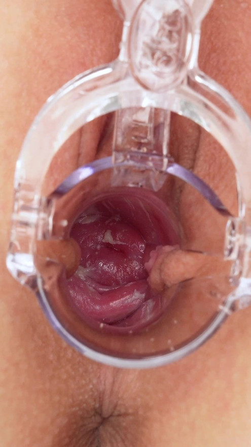 Uterus/cervix, Look How I Am Inside! Extreme Close-up