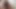 Lizzy Yum SD August 2025 Dilating #59