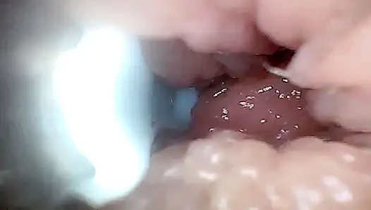 Visual Guide to G-spot Stimulation and Orgasm Endoscop Perspective
