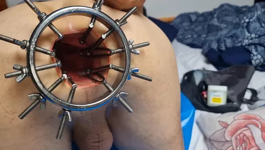Mega anal spreader openeing my asshole to the max!