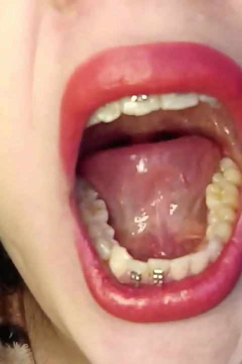 Consume Chews Gummies