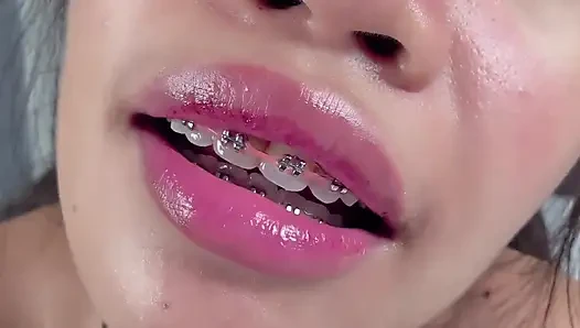 Besame mich oder ich entblößt dich