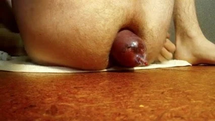 Pompa di, labbra anali gonfie parte 2