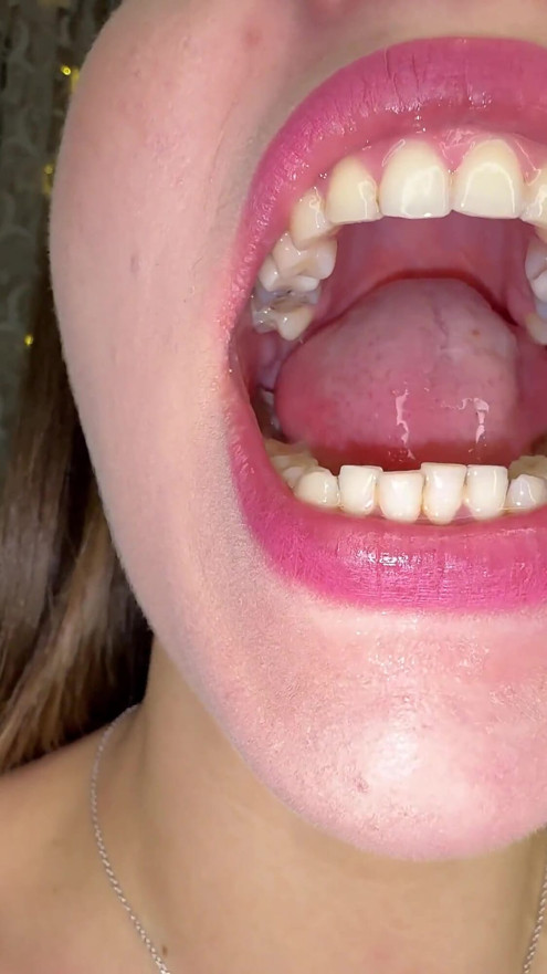 Mouth Secrets: Thick White Coating on My Tongue