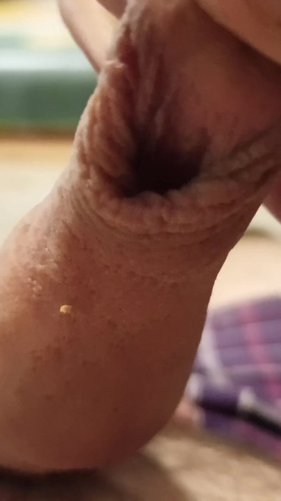 Prepúcio prepúcio pau sem cortes!