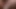 Amateur Big Dick solo anal compilation homemade porn USA America porn viral video moleking mole big thick dick teen pusssy