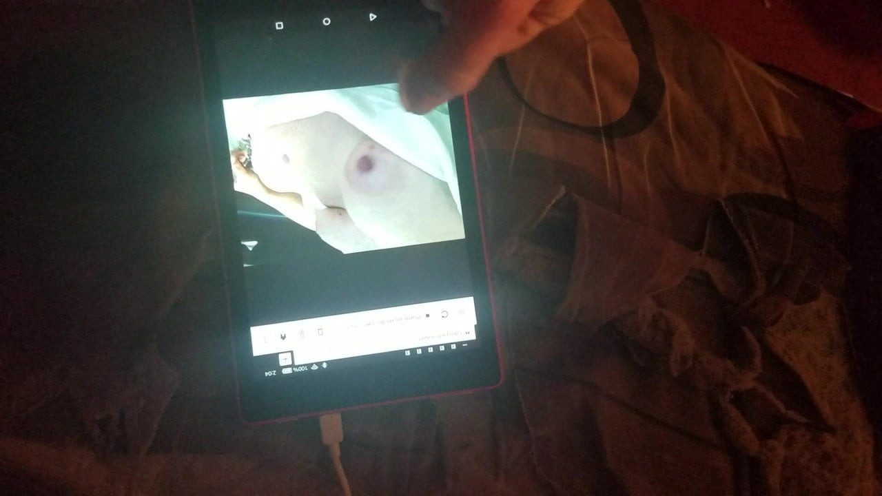 Hirsuteboy