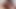 エボニーの継姉妹が私のペニスを使ってアナル - レイン・カーター - アナルセラピー - アレックス・アダムス