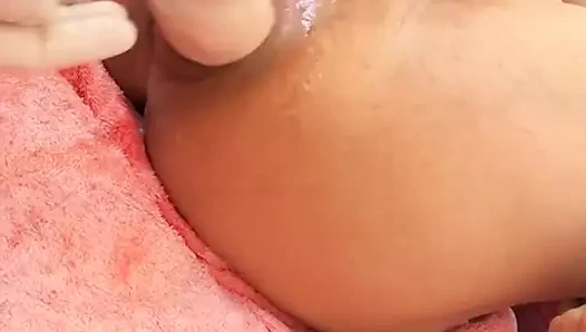 Fisting