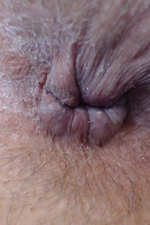 Panjat lubang pantatku
