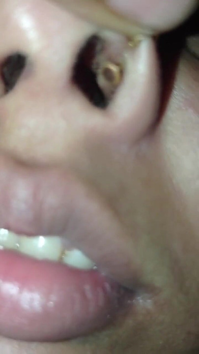 Spectacular moment from "Nose pulling Twisting pinching, Requested video Funny video"