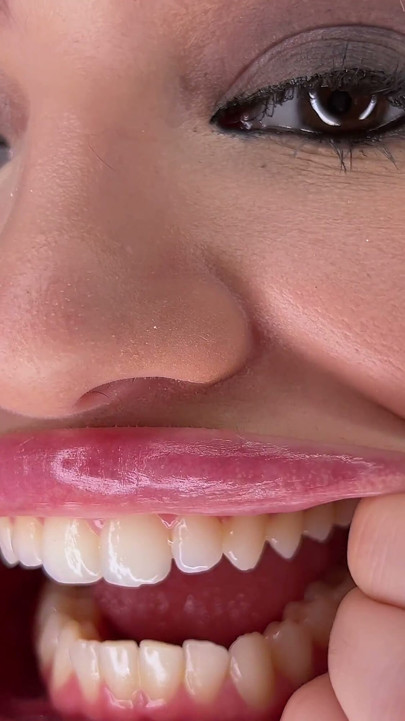 Extreme Mouth Spreading & Throat Closeupwide Open Mouth Fetish